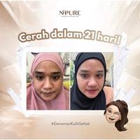 Gambar NPure Licorice Creamy Light Moisturizer dari Chen i-deal undefined 3 Tokopedia