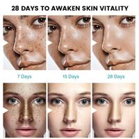 Gambar Dark Spot Corrector Cream Beauty Skin Care & Pigmentation Treatment dari ODEPO undefined 4 Tokopedia