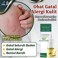 Gambar Obat Gatal Seluruh Badan Alergi Gatal Kulit Eksim Kering Menahun dari Affrian Herbal undefined 1 Tokopedia