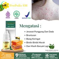 Gambar Obat Oles Jerawat Punggung Dada Leher Badan Bruntusan Biang Keringat dari Tiaraherbalofficial undefined 1 Tokopedia