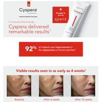 Gambar CYSPERA Cysteamine Intensive Pigment Corrector 15gr - 15gr dari Skin_clinic undefined 2 Tokopedia