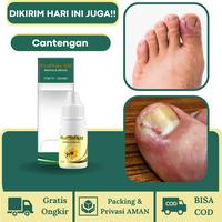 Gambar Propolis SM 100% Original Obat Cantengan, Obat Cantengan Kuku dari Herbalthy Store undefined 1 Tokopedia