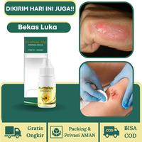 Gambar ProPolis SM Luka Basah Luka Kering Luka Bakar Luka Diabetes Luka Pasca Operasi Pengering Luka Penghilang Bekas Luka Pembersih Bekas Luka Obat Herbal Tetes Oles dari Herbalthy Store undefined 1 Tokopedia