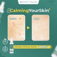 Gambar [BPOM] HERBIGLOW Miracle Water Acne & Glowing Skin Facemist 100 ml dari Herbiglow Official undefined 5 Tokopedia