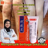 Gambar Ampuh salep krim penghilang bekas luka flek hitam original dari Qonita Herbal Store undefined 4 Tokopedia