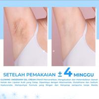 Gambar Zivaa Glowing Underarm Gel Cream - Cream pencerah Ketiak 50gr dari vandevan undefined 2 Tokopedia