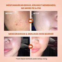 Gambar My Skin Hero -  [Buy 1 Get 1] The Papple Sleeping Jelly Mask (Night Moisturizer) dari My Skin Hero Official undefined 2 Tokopedia