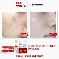 Gambar REAL WHITE Whitening Exclusive Package dari Real White Skincare undefined 3 Tokopedia