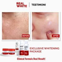 Gambar REAL WHITE Whitening Exclusive Package dari Real White Skincare undefined 4 Tokopedia
