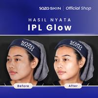 Gambar SOZO SKIN IPL Glow | Intense Pulsed Light dari Sozo Skin undefined 4 Tokopedia