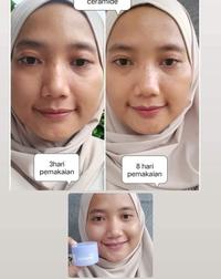 Gambar SR12 Skincare Ceramide Skin Barrier Care for All Skin Type Moisturizer Pencerah Pelembab dan  Pengencang Wajah dari Toko SR Herbal undefined 5 Tokopedia