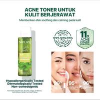 Gambar [BPOM] NPURE Face Toner Centella Asiatica 150 ml - 30 ml dari Marsheilla.jh undefined 3 Tokopedia