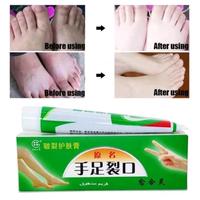 Gambar Salep Kaki Rayapan Bolong2 Kering Pecah2 Kaki Bau Penghilang Kutu Air dari VikaStore18 undefined 2 Tokopedia