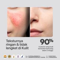 Gambar NPURE NONI PROBIOTICS “CALM ME DOWN” AMPOULE dari npureofficial undefined 4 Tokopedia