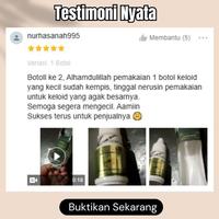 Gambar Obat Kutil, Papiloma, Daging Tumbuh, Kutil Di Leher Dan Wajah Propolis dari Surabaya Herbal Store undefined 3 Tokopedia