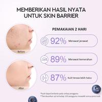 Gambar Terbatas Glad2Glow Blueberry 5% Ceramide Moisturizer 30G Glad2Glow Moisturizer Cream Krim Wajah 100% Ori Skincare dari Muhammadd Stuff undefined 4 Tokopedia