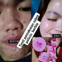 Gambar salep pelicin sci dari mayangsariolshop undefined 4 Tokopedia