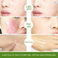 Gambar BPOM CINDYNAL Moisturizer Aloevera Gel 92% Pelembab Wajah Glowing - Gratis Hand Cream dari Slimming_healthyy undefined 5 Tokopedia