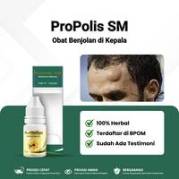 Gambar Obat Benjolan di Kepala, Penghilang Benjolan di Kepala, Propolis SM dari Fuji Herbal Shop undefined 1 Tokopedia