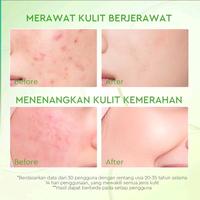 Gambar Glad2Glow Kiwi 3D Acid Acne Moisturizer 30g - Prlembab Wajah Jerawat Day & Night dari Mermaid123shop undefined 4 Tokopedia