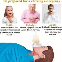 Gambar Puncak 1Set Choking Rescue Emergency Device /Poble Untuk Masker Pernafasan Anak Dewasa /1 Set Alat Bantu Keamanan /Alat Bantu Penyandang Anti Tersedak Untuk Cpr First Aid Masker Pernafasan Anak Dewasa dari Dede Pusat undefined 4 Tokopedia