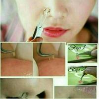 Gambar PINSET KOMEDO ALAT JEPIT CAPIT CABUT KOMEDO STAINLESS STEEL STERIL FACIAL EKSTRAKSI KOMEDO BLACKHEAD TWEEZER PEMBERSIH KOMEDO ACNE SKINCARE TOOLS PIMPLE COMEDONE REMOVER PERAWATAN PEMBERSIH WAJAH SALON KLINIK KECANTIKAN dari cbshopstore undefined 3 Tokopedia