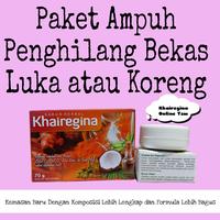 Gambar Salep Dan Sabun Penghilang Bekas Cacar / Bopeng / Jerawat / Luka - Cream dari Regina Herbal Store undefined 4 Tokopedia