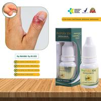 Gambar Obat Jempol Kuku Bengkak Bernanah dan Bau, Obat Cantengan Bernanah Berdarah, Obat Oles Jamur Kuku Rusak Menghitam dan Bau dari Nafiza herbal undefined 1 Tokopedia