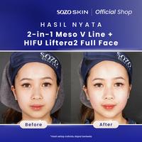 Gambar SOZO SKIN 2 in 1 Meso V Line + HIFU Liftera2 Full Face dari Sozo Skin undefined 3 Tokopedia