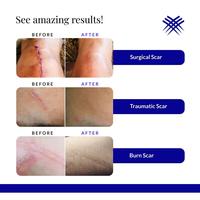 Gambar Rejuvasil Silicone Scar Gel 15ml Penghilang Bekas Luka dari KedaImport1717 undefined 5 Tokopedia