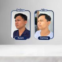 Gambar Istimewa Bromen Brhtening Extra ( Brhtening Soap + 7X Ceramide Moisturizer ) - Skincare Mencerahkan Kulit Wajah Pria dari Falahlh Mall undefined 5 Tokopedia