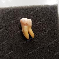 Gambar gigi praktikum molar asli,gigi 36 dari Afiffahsubroto undefined 1 Tokopedia