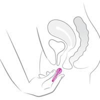 Gambar Intimina Lily Cup Ultra - Smooth Menstrual Cup Reusable Period Protect - Cup A-Pink Muda dari griya subur undefined 5 Tokopedia