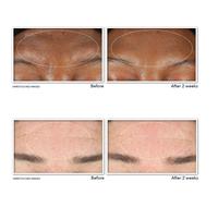 Gambar ROC - Retinol Correxion Deep Wrinkle Serum Cleanser dari Lux Flawlessly undefined 5 Tokopedia