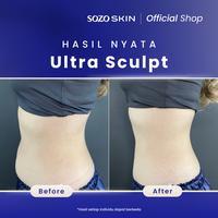 Gambar SOZO SKIN Ultrasculpt Slimming - 6X dari Sozo Skin undefined 3 Tokopedia