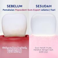 Gambar Pepsodent Toothpaste Pasta Gigi Gum Expert Fresh Jaga Gusi Rekat Pada Gigi 100g dari Unilever Mall Official undefined 4 Tokopedia