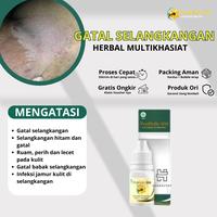 Gambar Salap gatal kulit obat gatal selangkangan salep gatal Obat Gatal Seluruh Badan Obat Gatal Kelamin Obat Gatal Selangkangan Menghilangkan Bau ProPolis SM dari Herbalthy Store undefined 1 Tokopedia