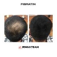 Gambar FIBRATIN Fiber Filler Penebal Rambut Hasil Natural Bebas Gumpal Travel Size dari Irwan Team undefined 4 Tokopedia