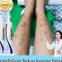 Gambar Mantap Netpac 100%Original Dermatix Penghilang Bekas Luka Koreng Advanced Scar Gel Dermatik Obat Bekas Luka Luka Jahitan Bekas Luka Jerawat Dan Stretch Marks Penghilang Strechmark Ampuh 15G dari arasiteru undefined 1 Tokopedia