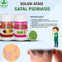 Gambar Obat Borok Penghilang Bekas Budug Di Kaki Tangan Badan, Gatal Kudis, Kurap Kulit Di Kepala Berjamur, Bernanah, Tangan, Kaki Paling Ampuh dari tokomekarjayaabadii undefined 1 Tokopedia