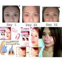Gambar ORIGINAL NOSE UP CLIPPER ALAT PEMANCUNG HIDUNG ALAMI 100% ORIGINAL dari Sean Beauty Store undefined 3 Tokopedia