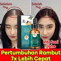 Gambar serum penumbuh rambut paling ampuh 30ml,penumbuh rambut botak pria,serum rambut rontok rusak,penumbuh rambut cepat,serum penumbuh rambut botak,obat rambut rontok parah wanita,vitamin penumbuh rambut botak dari Aestetic Skin undefined 1 Tokopedia