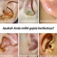 Gambar Terlaris 【100% Original】Obat Paling Ampuh Telinga Bernanah Obat Telinga Sakit 30ML Obat Tetes Telinga Bernanah,Obat Tetes Telinga Berair,Sakit Telinga,Kuping Sakit, Infeksi Telinga,Telinga Gatal,Menghilangkan kotoran dari telinga, Menyembuhkan masalah - beli 3 gratis 2 dari AS SYIFA HATI undefined 3 Tokopedia
