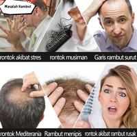 Gambar Serum Pertumbuhan Kebotakan Cepat, Obat Pertumbuhan Rambut, Pertumbuhan rambut, Pertumbuhan Rambut Cepat, Anti Rambut Rontok, Semprotan Pertumbuhan Rambut 100ml untuk Rambut Rontok Parah, Rambut Menipis, Serum Penumbuh Rambut Paling Ampuh - Paket 3 dari PINKKY-STORE undefined 3 Tokopedia