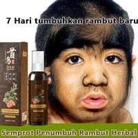 Gambar Serum Pertumbuhan Kebotakan Cepat, Obat Pertumbuhan Rambut, Pertumbuhan rambut, Pertumbuhan Rambut Cepat, Anti Rambut Rontok, Semprotan Pertumbuhan Rambut 100ml untuk Rambut Rontok Parah, Rambut Menipis, Serum Penumbuh Rambut Paling Ampuh - Paket 3 dari PINKKY-STORE undefined 1 Tokopedia