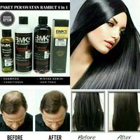 Gambar ready.. Paket BMKS 4in1 Shampoo Conditioner Minyak Kemiri Hair Tonic Original Bpom Vitamin Obat Perawatan Penyubur Penumbuh Pemanjang Pelurus Penebal Rambut Kering Dan Rusak Rontok Botak Pria Wanita Secara Cepat Tercepat dari jasmine - store undefined 3 Tokopedia