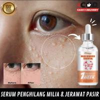 Gambar Serum penghilang MILIA dibawah mata remover serum dari Litha'Shop undefined 1 Tokopedia