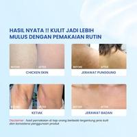 Gambar RINTIK SKINCARE NO BUMP LOTION GENTLY EXFOLIATES BUMPLOTION BUMPY SKIN 100ML CHICKEN SKIN NOBUMP BY RINTIKSKINCARE dari Farradisa_id undefined 2 Tokopedia