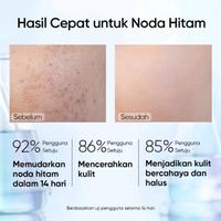 Gambar SKINTIFIC - Symwhite 377 Dark Spot Serum 20ml dari Gudang Sehat Store undefined 4 Tokopedia