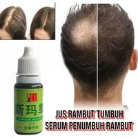 Gambar JUS RAMBUT TUMBUH EYELASH & BROW GROWTH SERUM PENUMBUH ALIS & BULU MATA LEBAT & CEPAT  SERUM PENUMBUH RAMBUT - 1 pcs dari Female angel shop undefined 2 Tokopedia